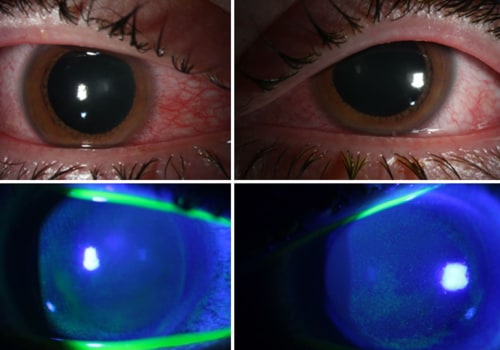 The Truth About UV Light Ozone and Its Effects on Health